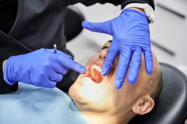 Best Urgent Care for Lost Fillings or Crowns in Milford City, CT