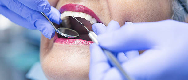 Best Emergency Dental Care for Broken or Chipped Teeth in Milford City, CT
